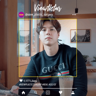 [Eye Surgery, Nose Surgery] Jinwoo Kim