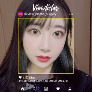 [3 Types Face Countouring+Rhinoplasty+Double Eyelid Revisional Surgery+Pyriform Augmentation+Fat Graft] An Bogyeong